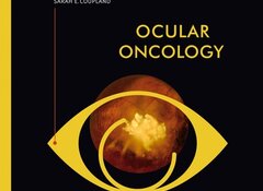 Bożena Romanowska-Dixon, Martine J. Jager, Sarah E. Coupland: Ocular Oncology, PZWL Wydawnictwo Lekarskie 2020